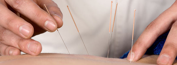 Infoabend: Akupunktur- und TCM-Ausbildung – Image 1
