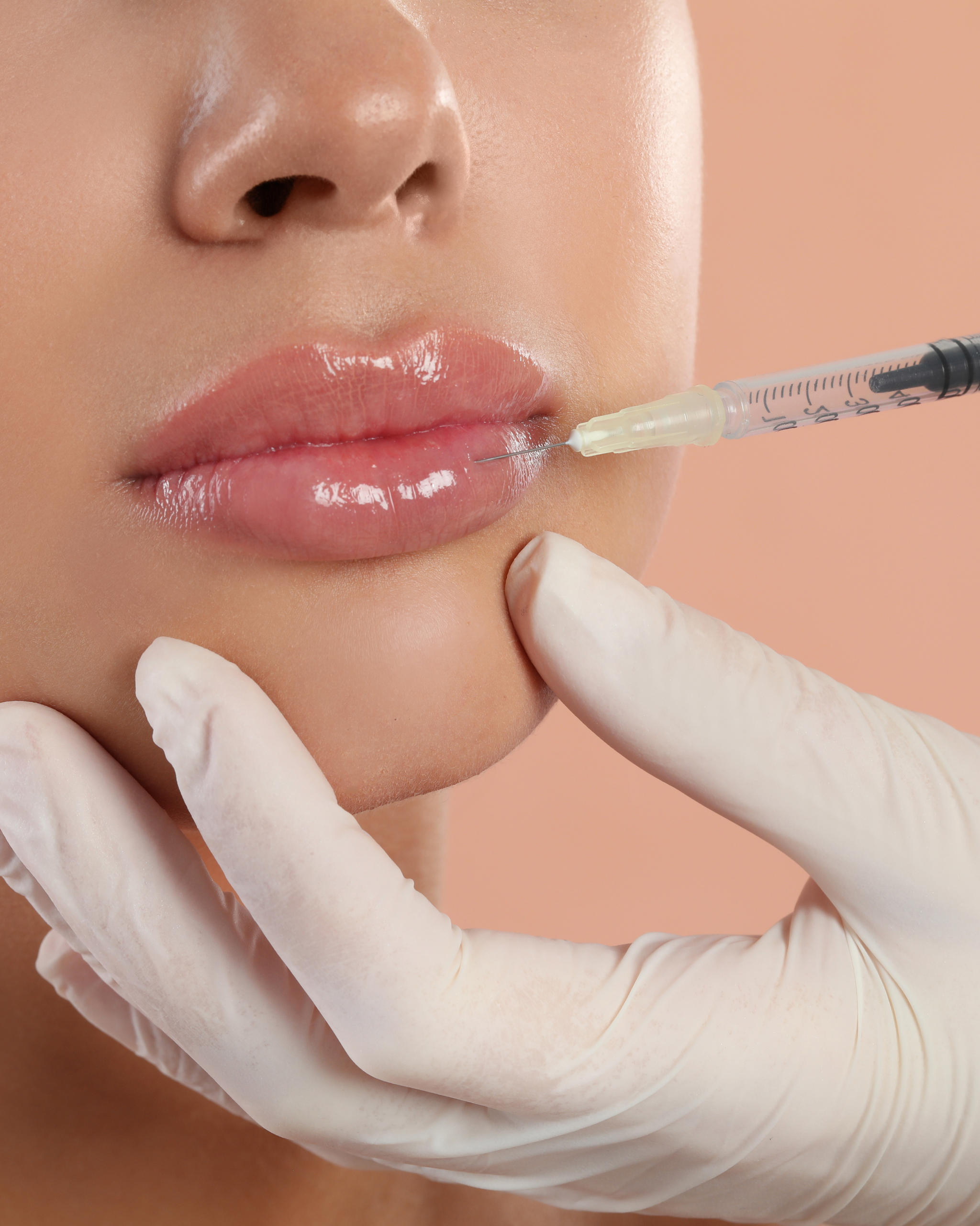 Dermal Fillers