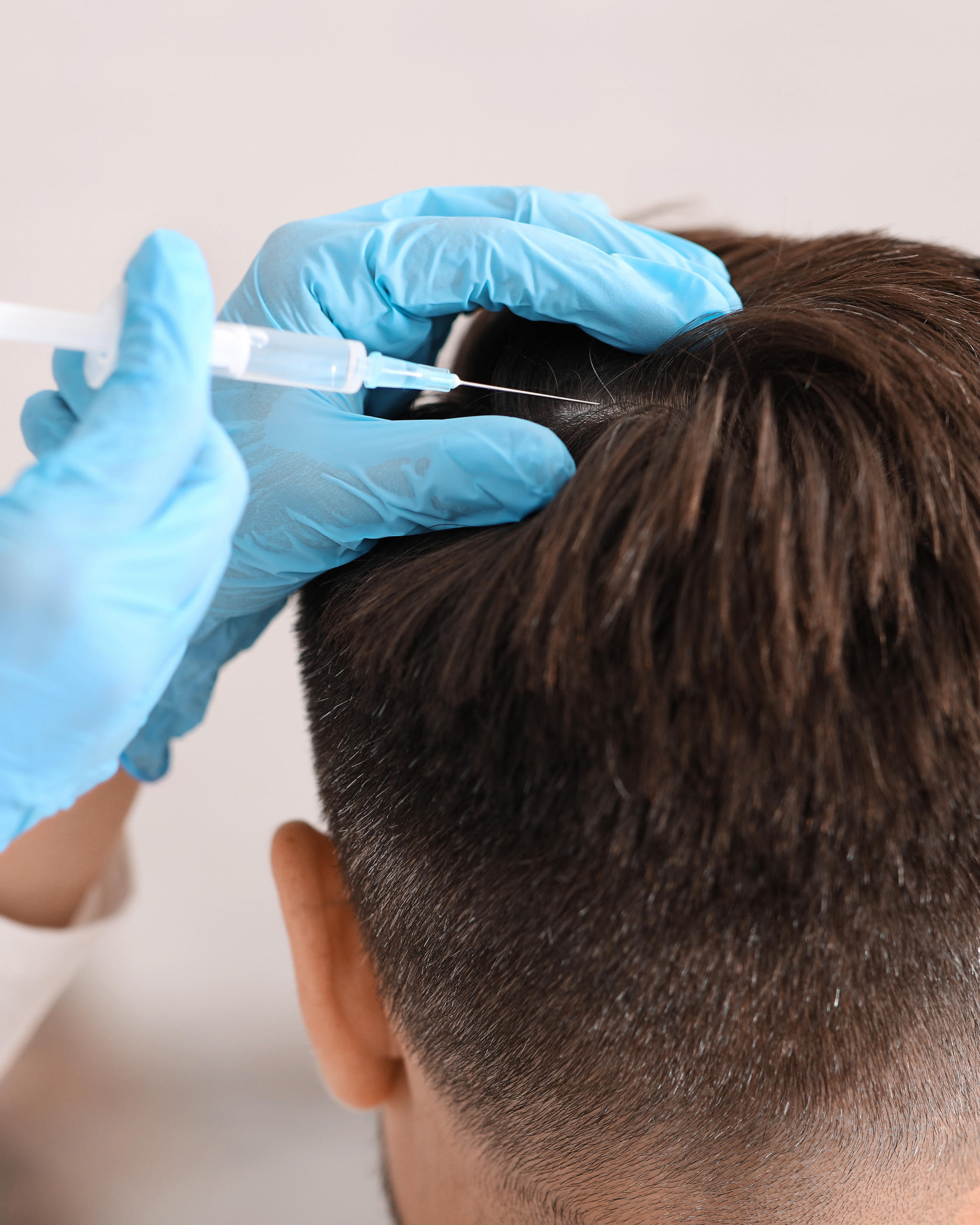 PRP Therapy