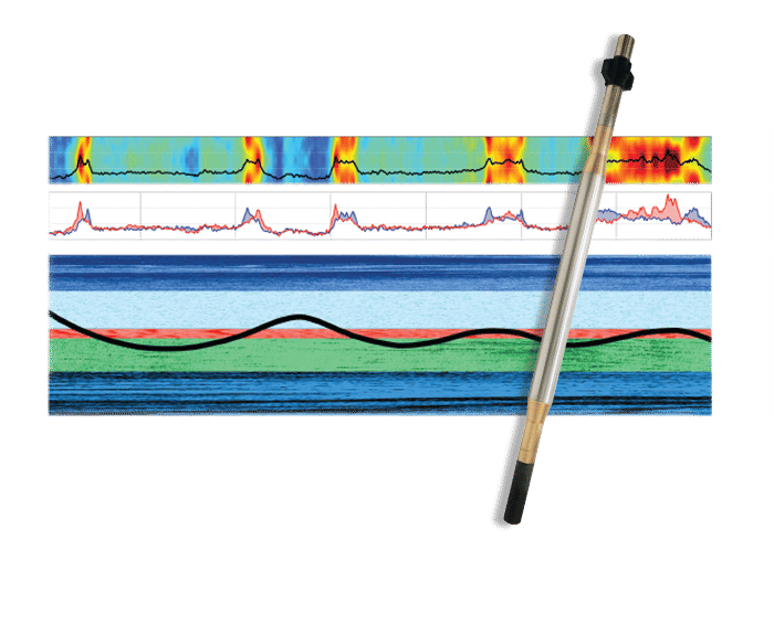 Vertex Downhole life at company image