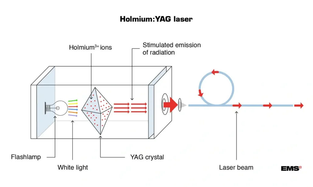 Diagram of Holmium:YAG laser showing flashlamp, YAG crystal with Holmium ions, stimulated emission, and laser beam output.