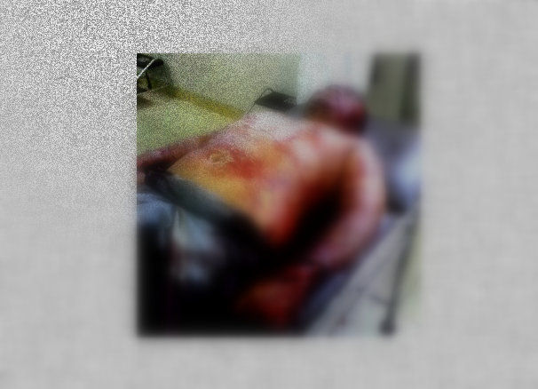 Warga Sumenep Tewas ‘ditangan’ Ketua PKB Ganding