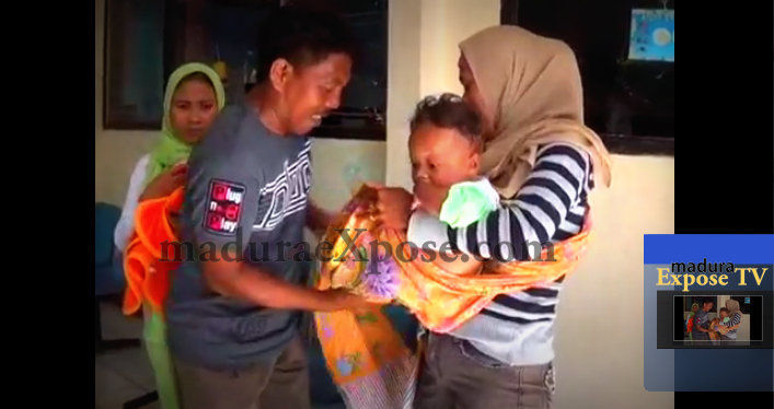 Penuh Bintik Merah, Kaki Irwan Membengkak Sebesar Buah Kelapa