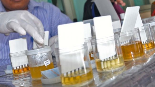 Kanit Narkoba Ditembak Polisi, 70 Anggota Langsung Dites Urine