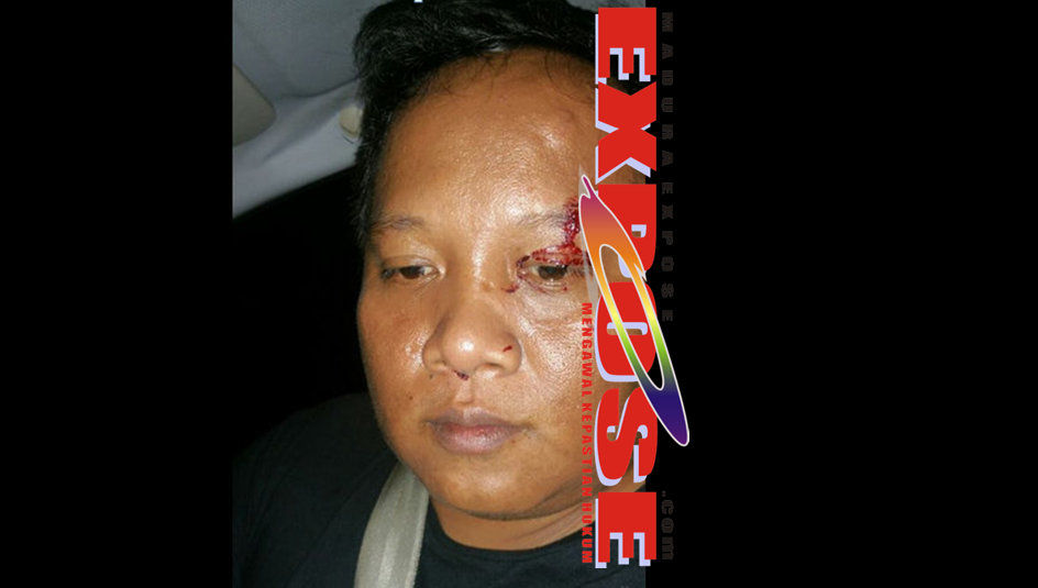 Breaking News: Bos Akik Asal Sumenep Dihajar Oknum Polisi di Surabaya