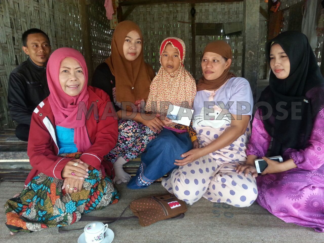 Bocah Cantik  Di Pamekasan Menderita Kangker Bibir