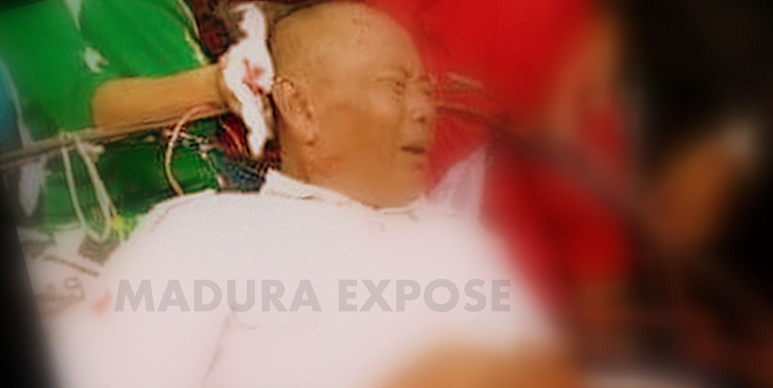Warga Pamekasan Dibacok Hingga Sekarat