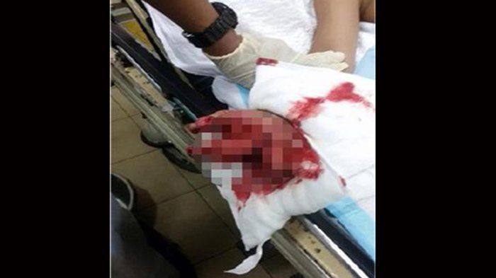 Ledakan Mirip Bom di Pamekasan, 2 Warga Tewas
