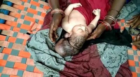 Bayi Berkepala Tiga di India Ini Diklaim Sebagai Inkarnasi Tuhan Oleh Warga