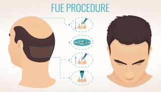 Hair Transplant Clinic screenshot