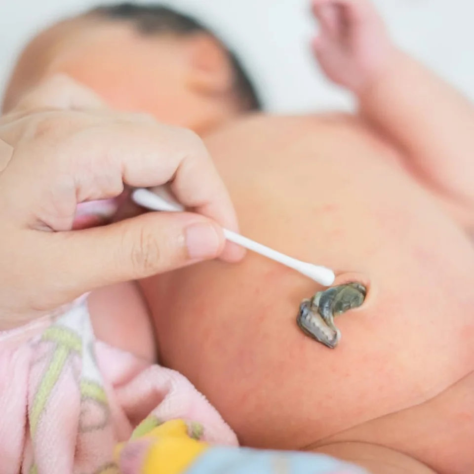 Cuidados e higiene del ombligo del bebé recién nacido