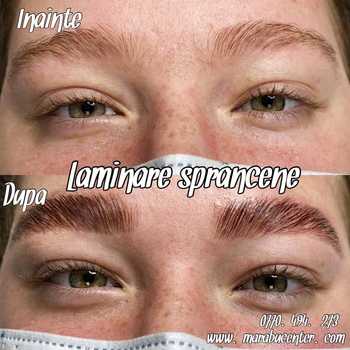 Laminare_sprancene Marabucenter_laminare_sprancene