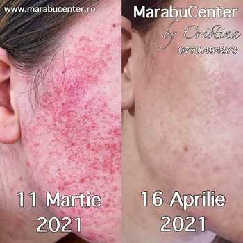 Salon_Marabu_tratament_facial Salon_Marabu_tratament_facial