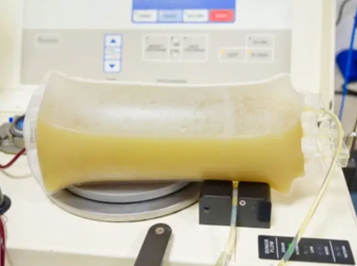 Máy kiểm tra mỡ máu