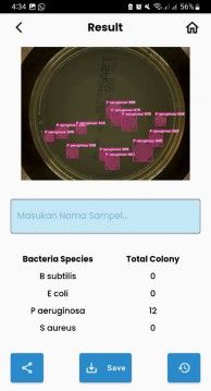 Bacteria Detector