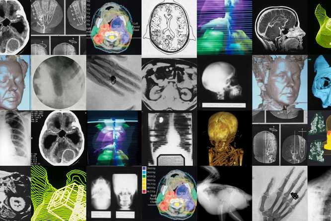 (Images courtesy of Mallinckrodt Institute of Radiology)
