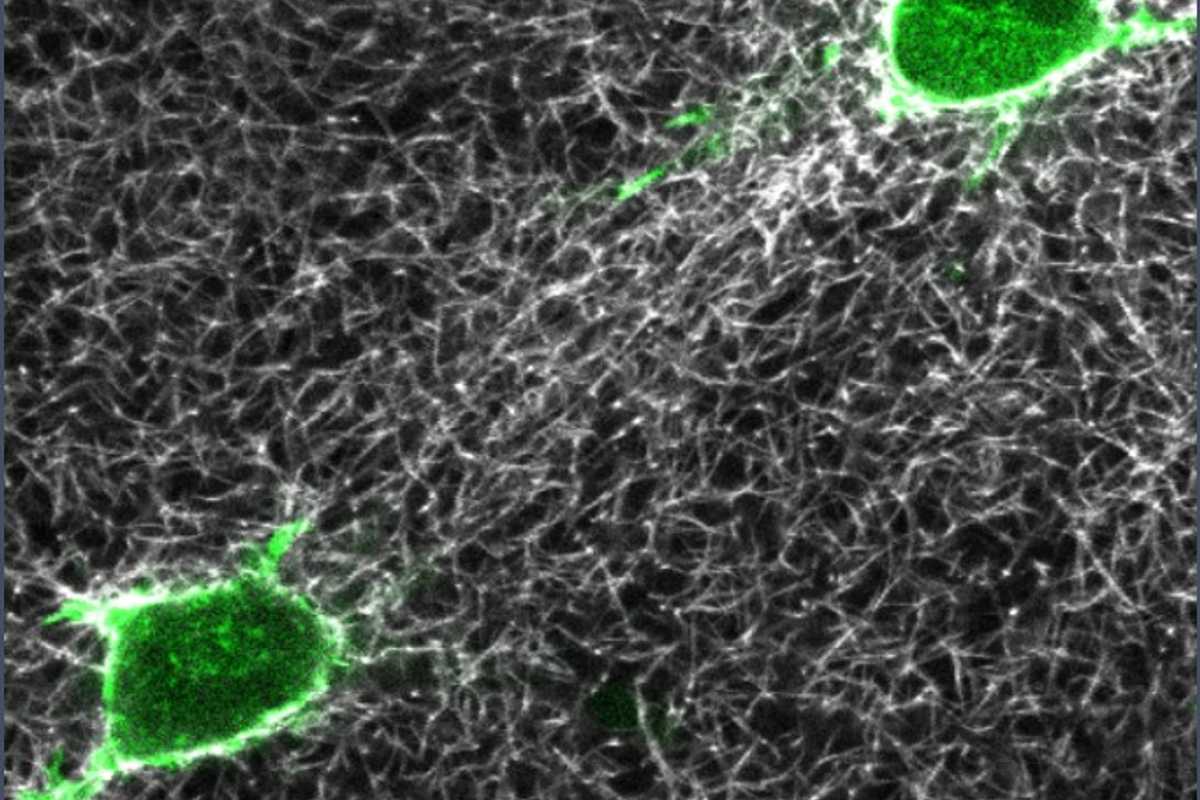 A team of researchers from Israel, the United Kingdom, Spain and the United States have been awarded a three-year, $1.5 million grant from the Human Frontiers Science Program to study cell-to-cell communication through vibrations. (Image credit: Lesman lab)