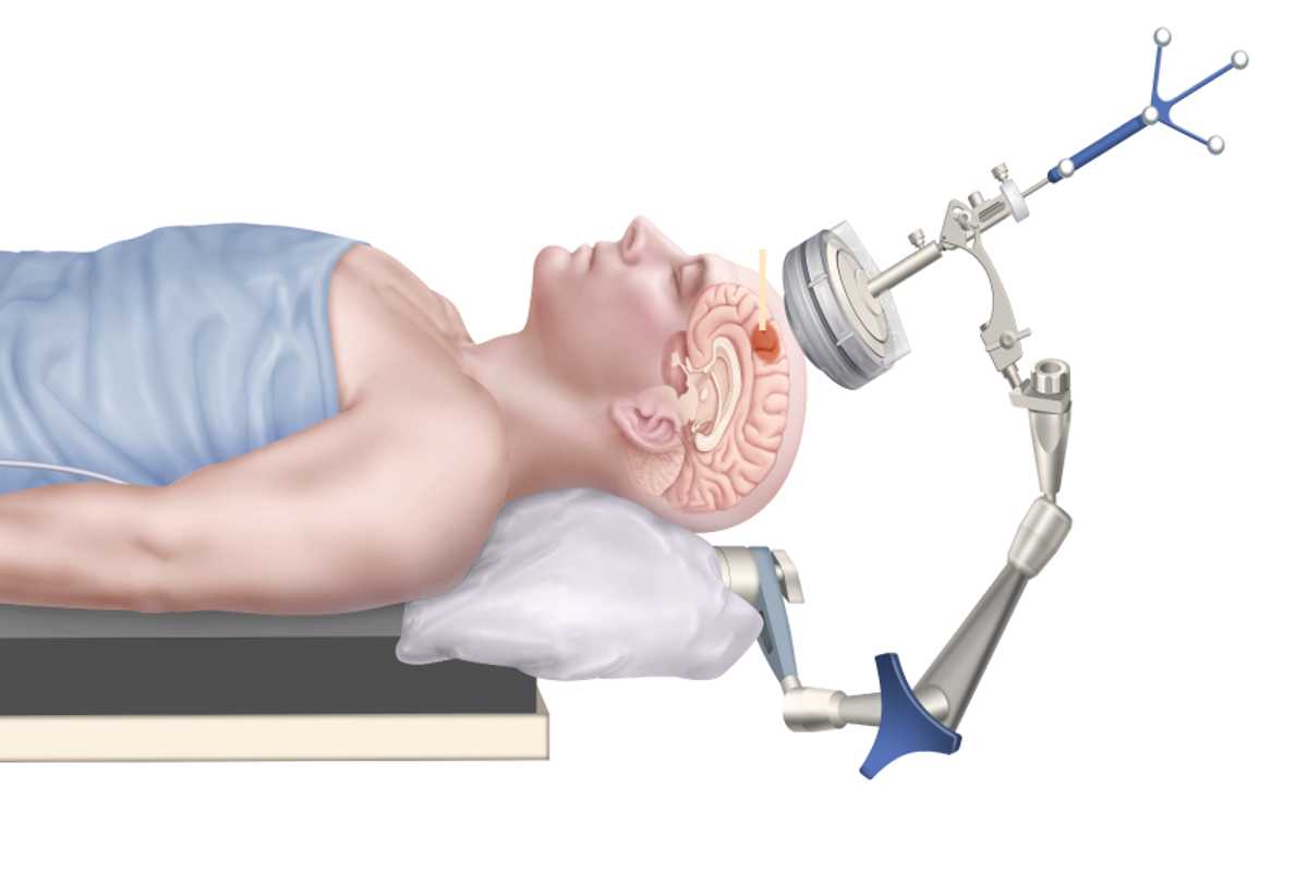 Hong Chen and her team, including doctoral student Chih-Yen Chien, developed a quality assurance protocol to ensure their guided focused ultrasound device and treatment is safe and functions consistently. (Credit: Chen lab)