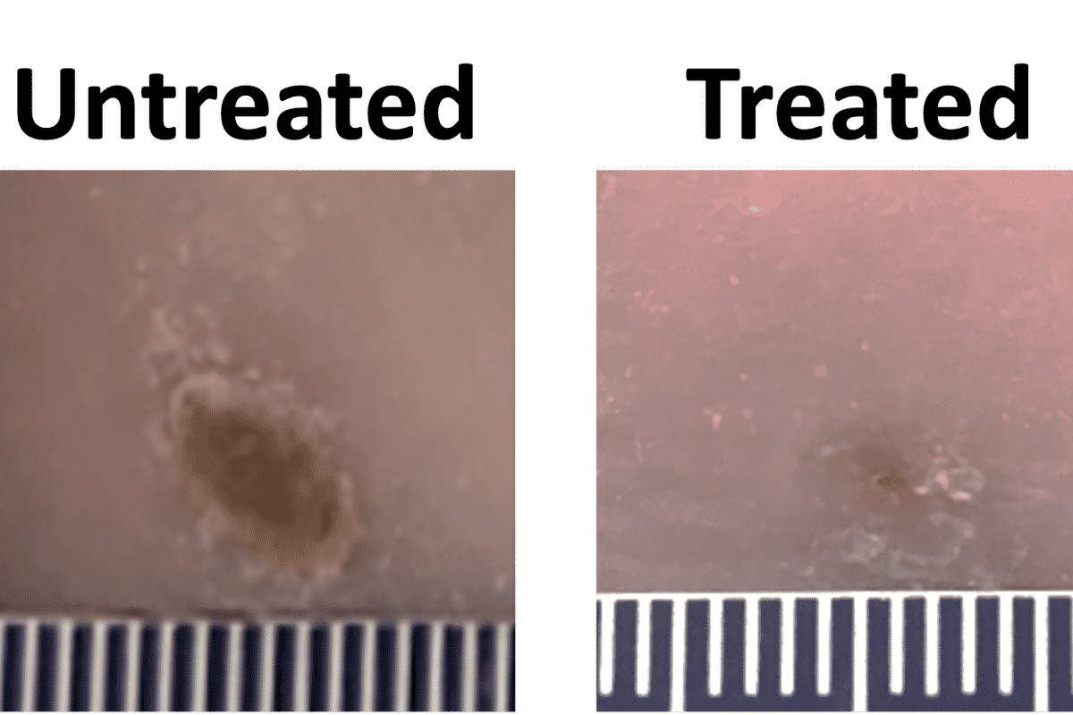 In early experiments, Jianjun Guan and his team found that after applying a single dose of their wound dressing into wounds in young diabetic mice, the wounds completely closed at day 14. Wounds that were treated only with the hydrogel or were untreated were reduced to roughly half of their original size. (Guan lab)