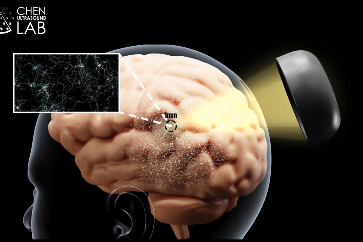 Hong Chen and her team plan to integrate ultrasound with genetics to precisely modify neurons in the brain with their Sonogenetics 2.0 technology. (Credit: Chen lab)  