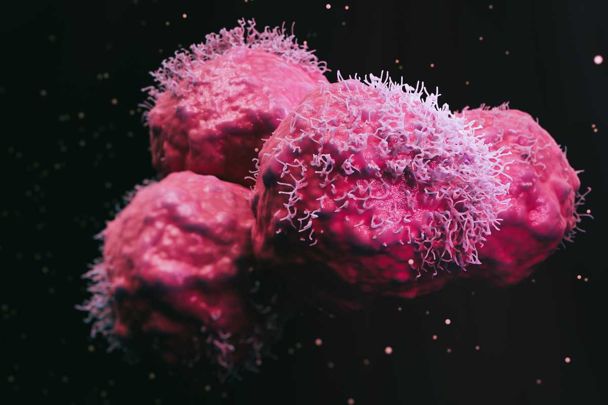 Detailed knowledge of how cells mechanically sense their environments is crucial to understanding processes like cancer and wound healing, where groups of cells might aggregate or migrate around stiff tissues and tumors. (iStock)