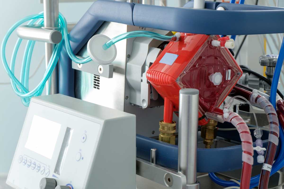 An interdisciplinary team of researchers at Washington University in St. Louis has developed a new machine-learning model to assist clinicians in making the difficult decision on which patients should get ECMO treatment. (Credit: iStock photo)