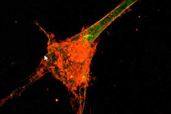 Stopping cell protrusions pictured here at the early stages of extracellular matrix formation inhibits activation of fibroblasts and unwanted fibrosis. (Image credit: Center for Engineering Mechanobiology).