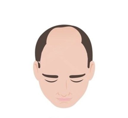 Stage 4