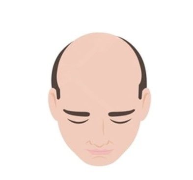 Stage 5