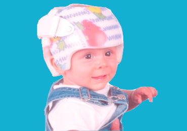 Orthotic helmet