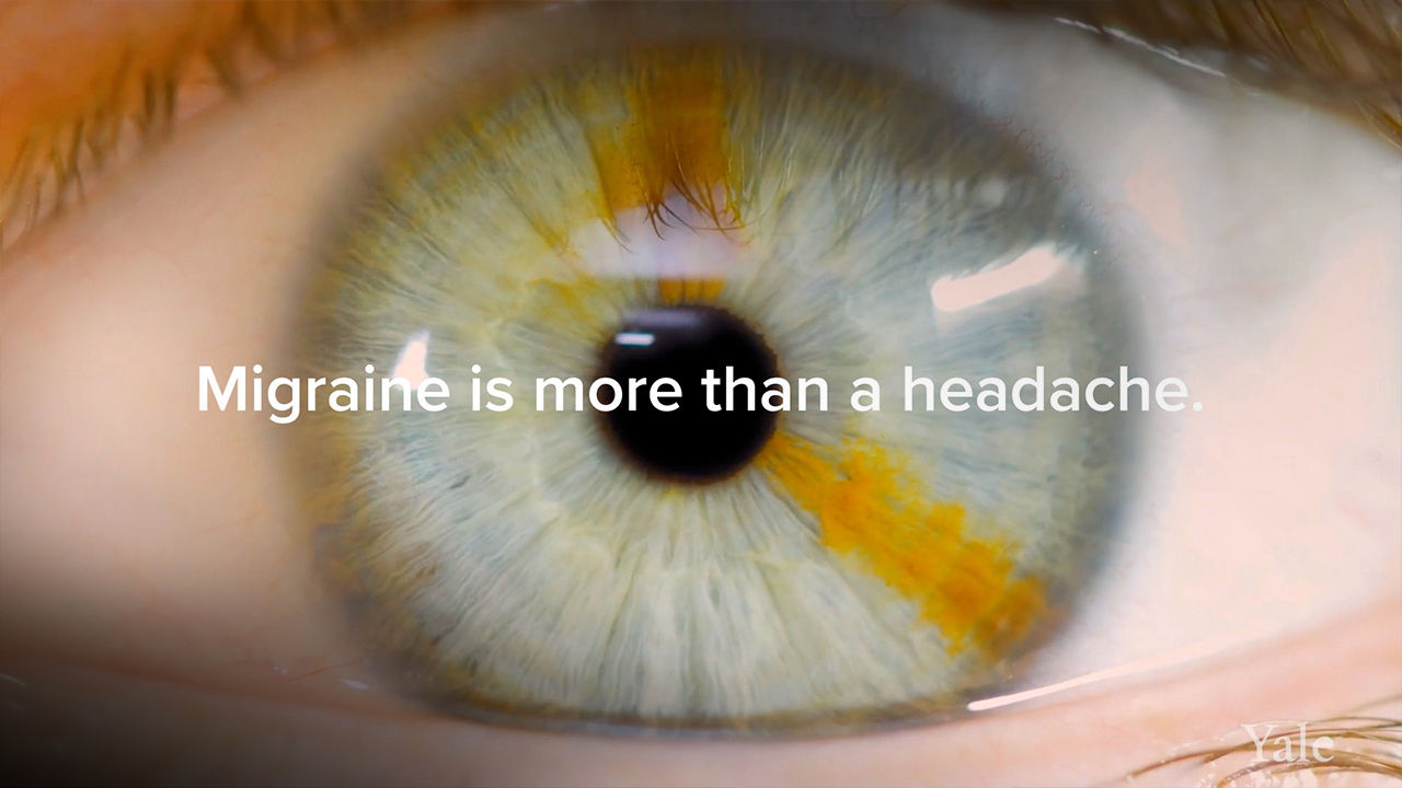 Migraine | A Neurological Condition That's Not Just in Your Head