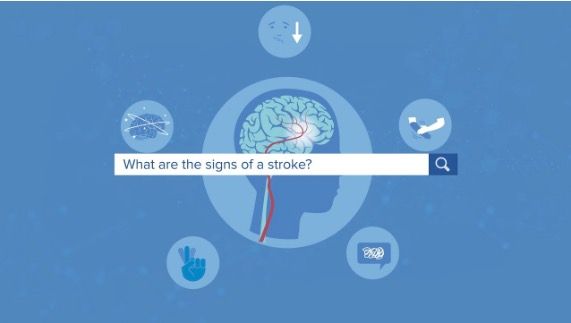 The Signs of a Stroke | Yale Medicine Explains