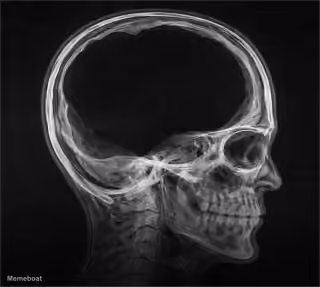 90% Brain Mass Missing / No Brainer