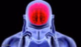 brain damage