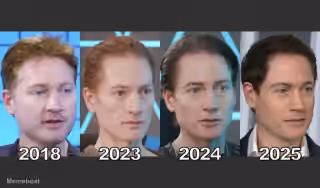 Bryan Johnson Progression from 2018 to 2025