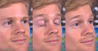 Drew Scanlon 'Wait, What?' - Blinking White Guy