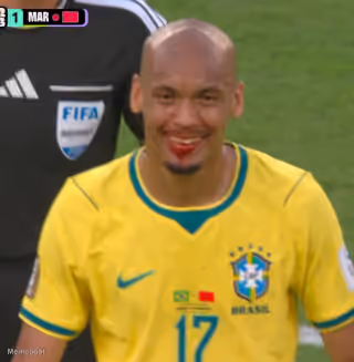 Fabinho's Vampire Smile