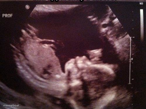 Fetus Cat Ultrasound - meme generator image preview
