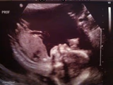 Fetus Cat Ultrasound