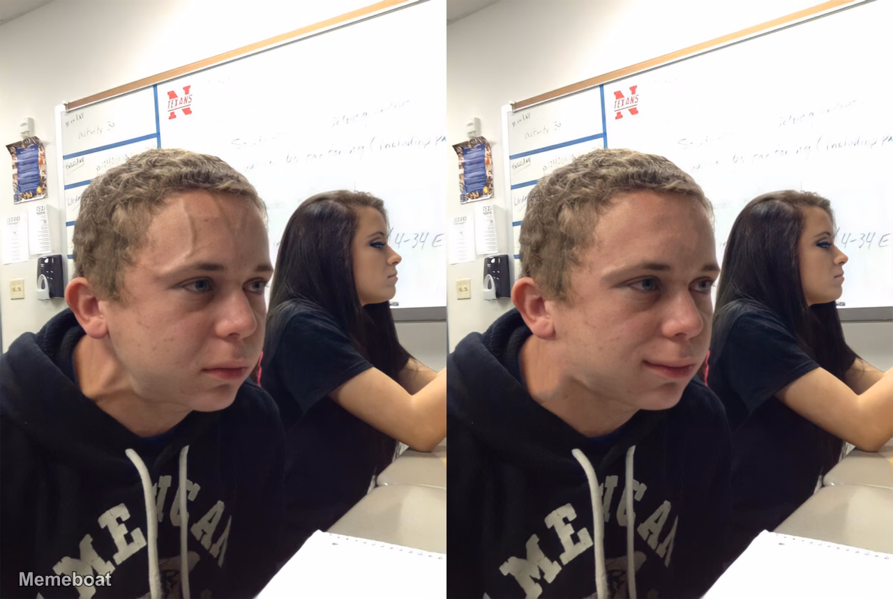 Forehead Vein - meme generator image preview