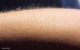 Goosebumps
