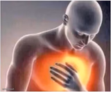 heart burn