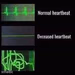 heart monitor