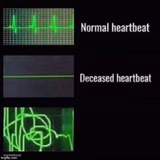 Heartbeat comparisons