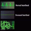 heartbeat rate