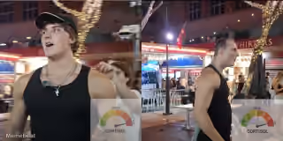 Kick Streamer Androgenic Hairline Before vs After