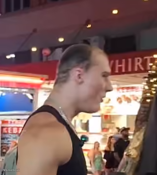 Kick Streamer Receding Hairline