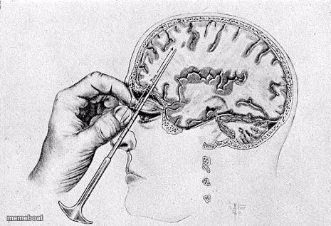 Lobotomy - meme generator image preview