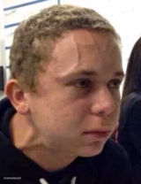 neck vein guy