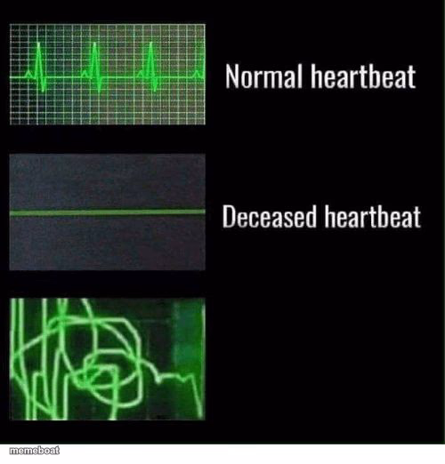 normal heartbeat deceased heartbeat - meme generator image preview
